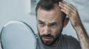 Ist erblich bedingter Haarausfall zu stoppen?
