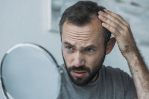 Ist erblich bedingter Haarausfall zu stoppen?